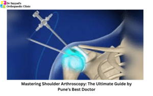 Shoulder Arthroscopy